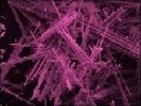 Asbestos Fibers Under a Microscope
