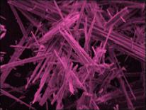 Microscope view of Asbestos Fibers